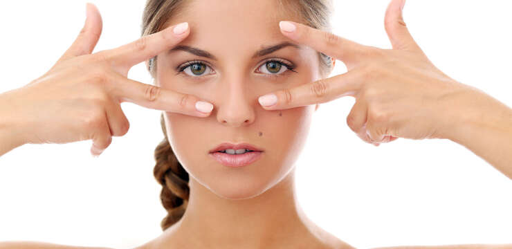 Blepharoplasty