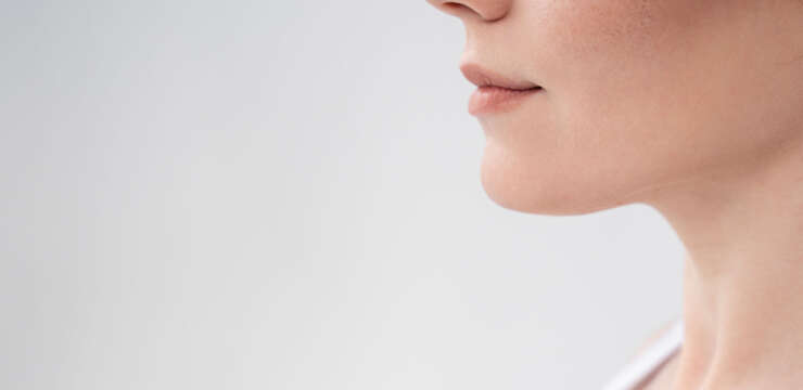 Chin Augmentation
