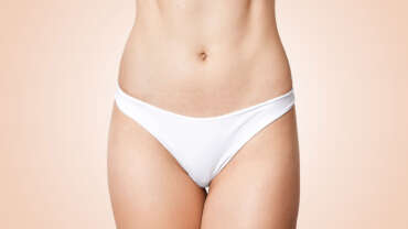 Vaginoplasty