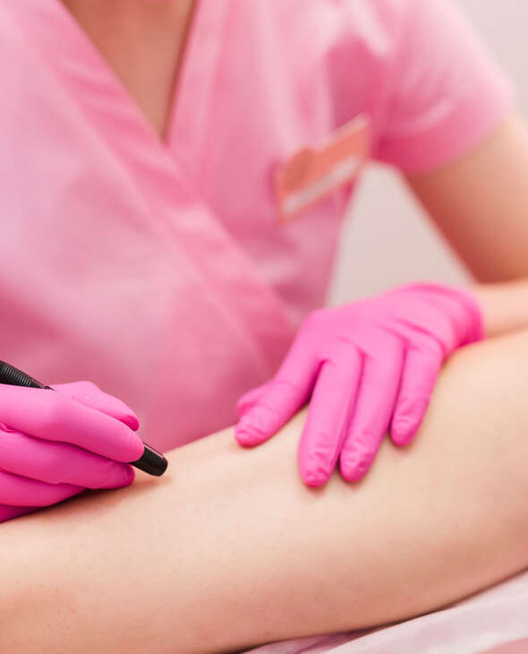 Spider Vein Treatment