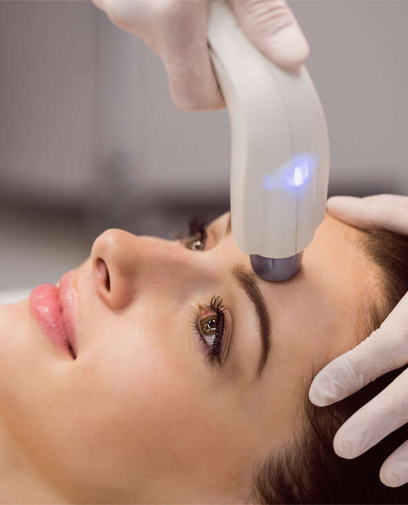 LASER resurfacing