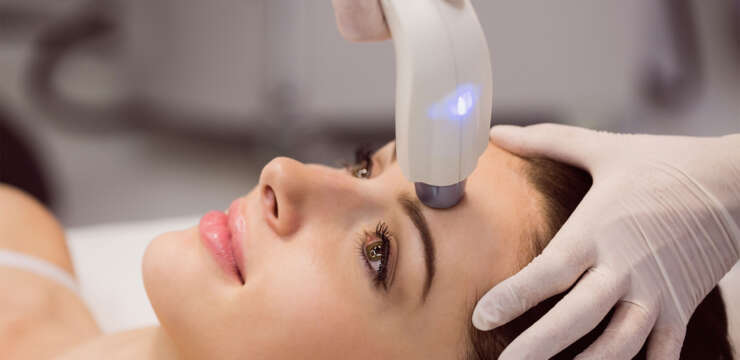 LASER resurfacing