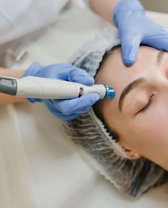 Microdermabrasion