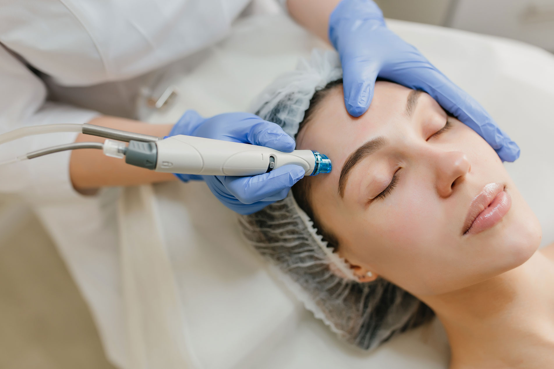 Microdermabrasion