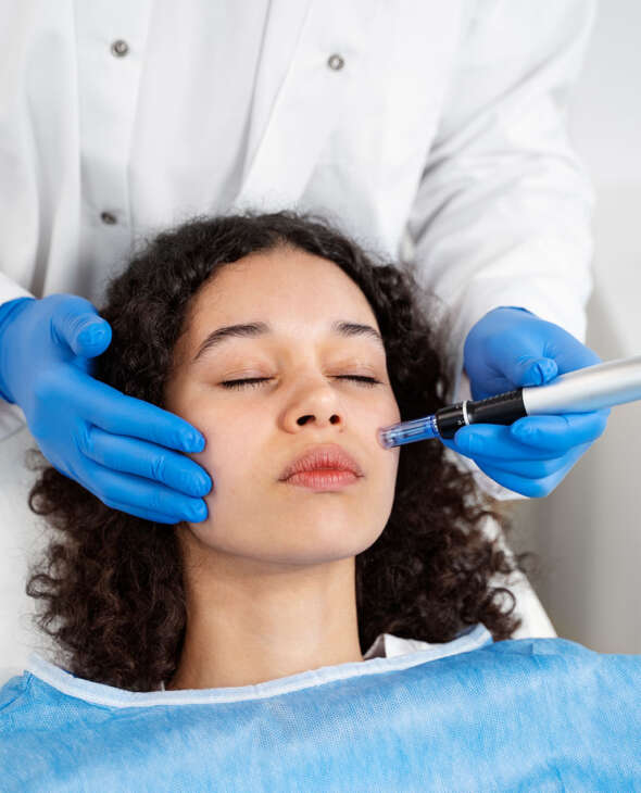 Microneedling