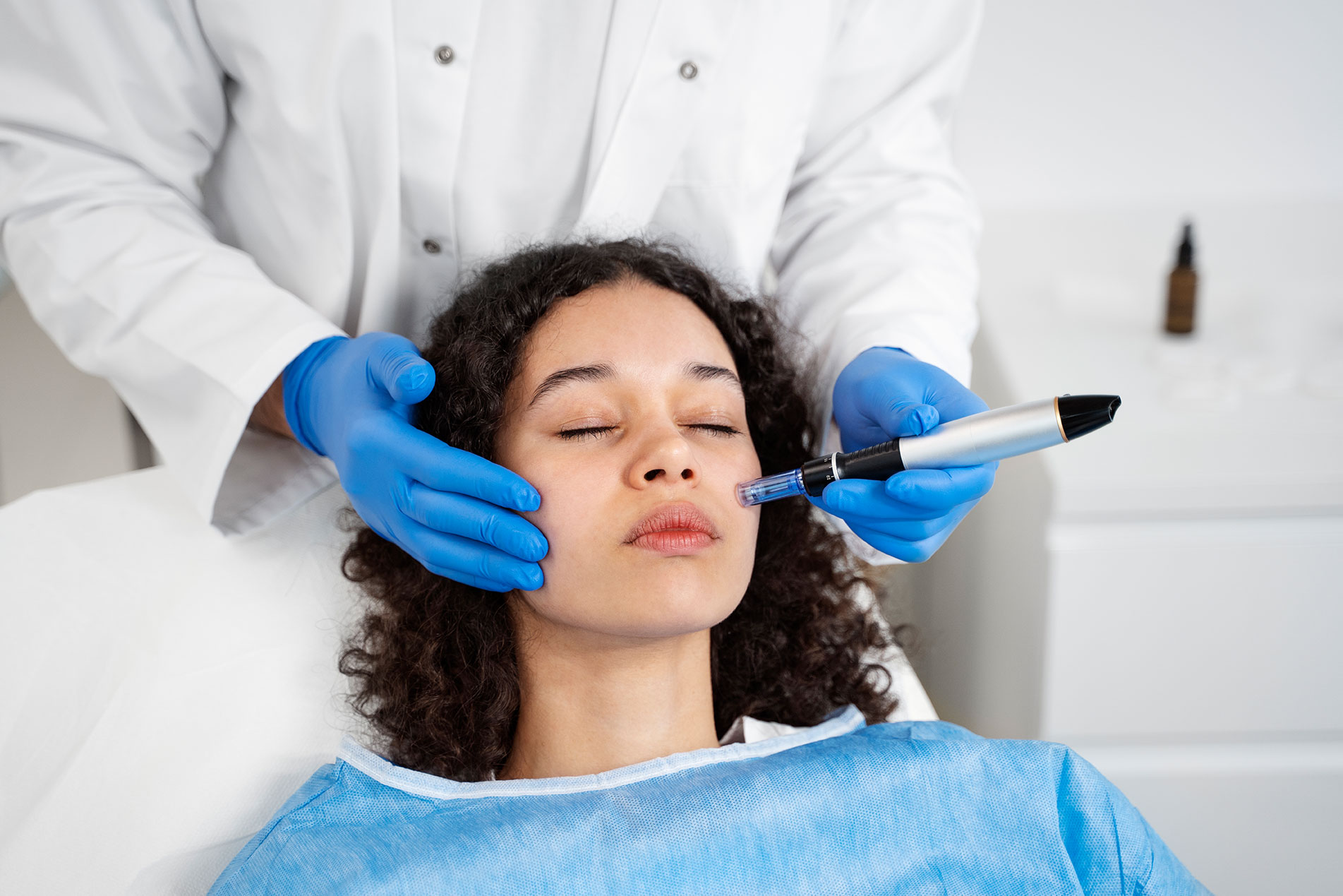 Microneedling